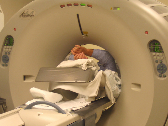 CT Heart scan - Coronary Calcium Score